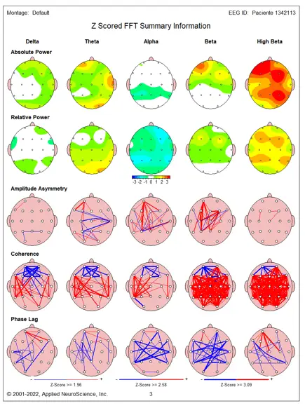 imagen de evaluacion qeeg para hacer neurofeedback